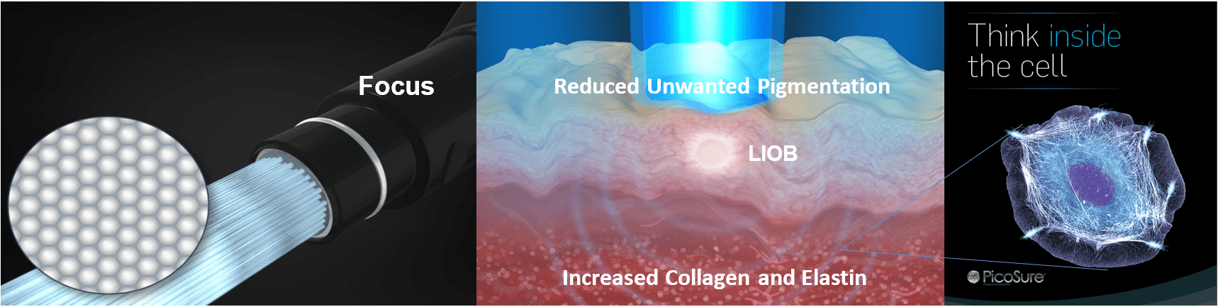 Learn the details on PicoSure Focus laser skin revitalization.