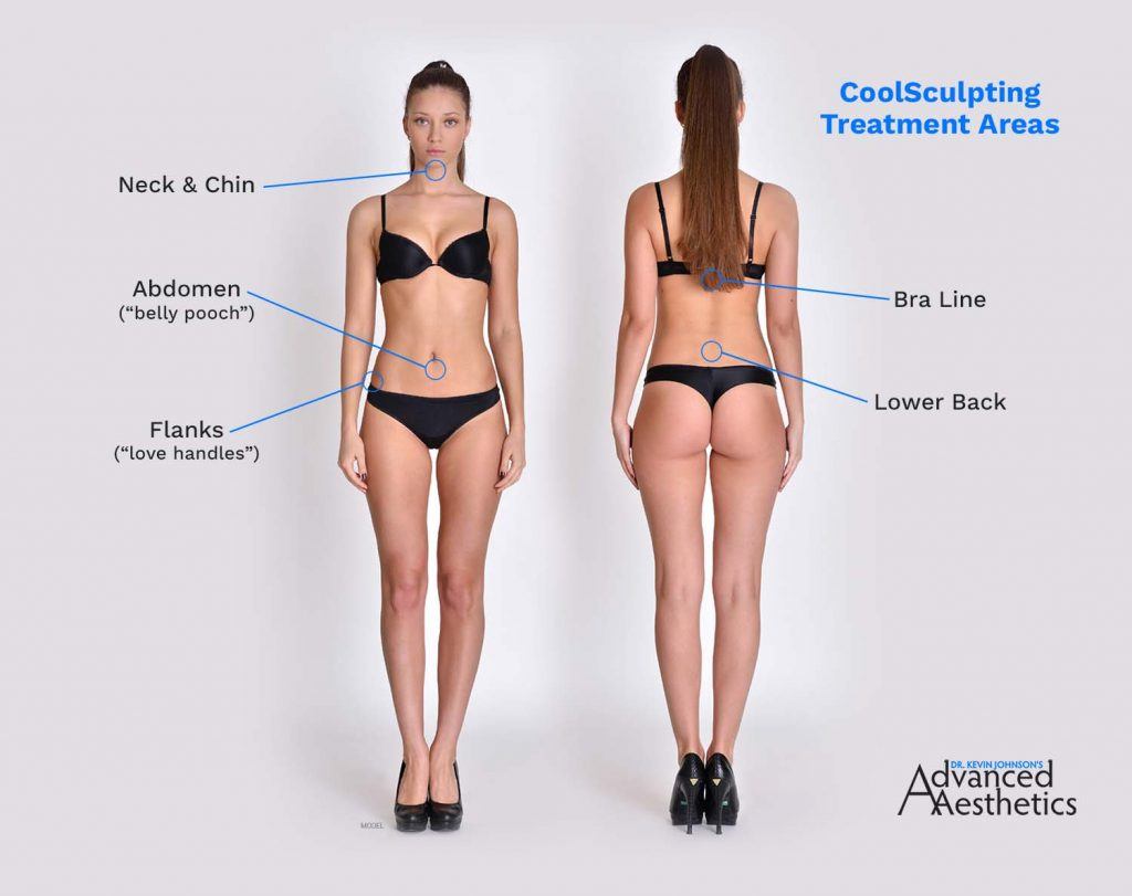 Diagram of Coolscultping Treatment Areas