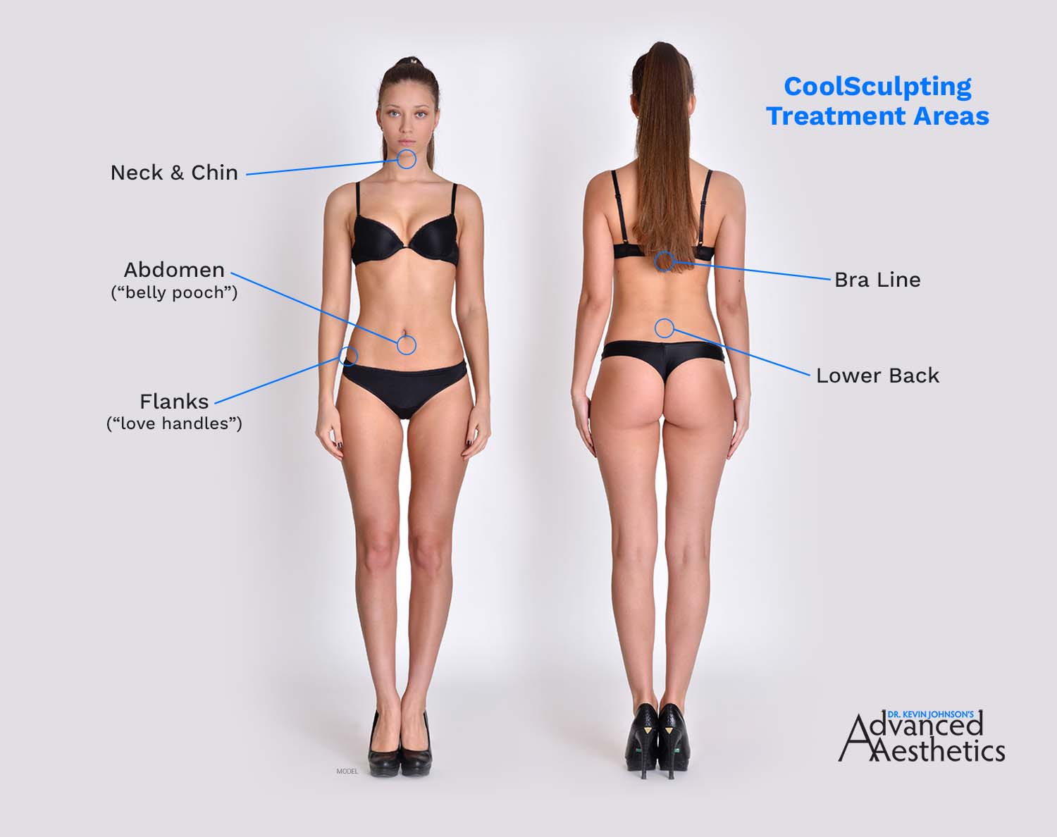 CoolSculpting Elite, reducing fat on tummy & flanks, before and after