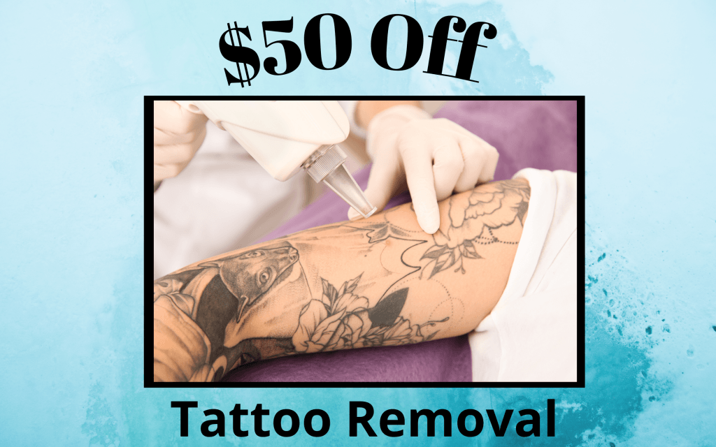 $50 Off Tattoo Removal Promotion (model)