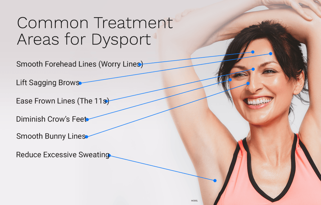 Treatment areas with botox and dysport for worry lines, sagging brows, crow's feet, bunny lines, and reduce sweating