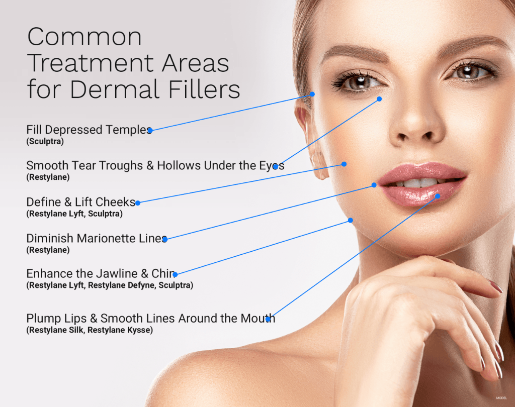 Treatment areas using dermal fillers for depressed temples, smoothing tear troughs, lift cheeks, diminish marionette lines, enhance jaw and chin, and plump lips