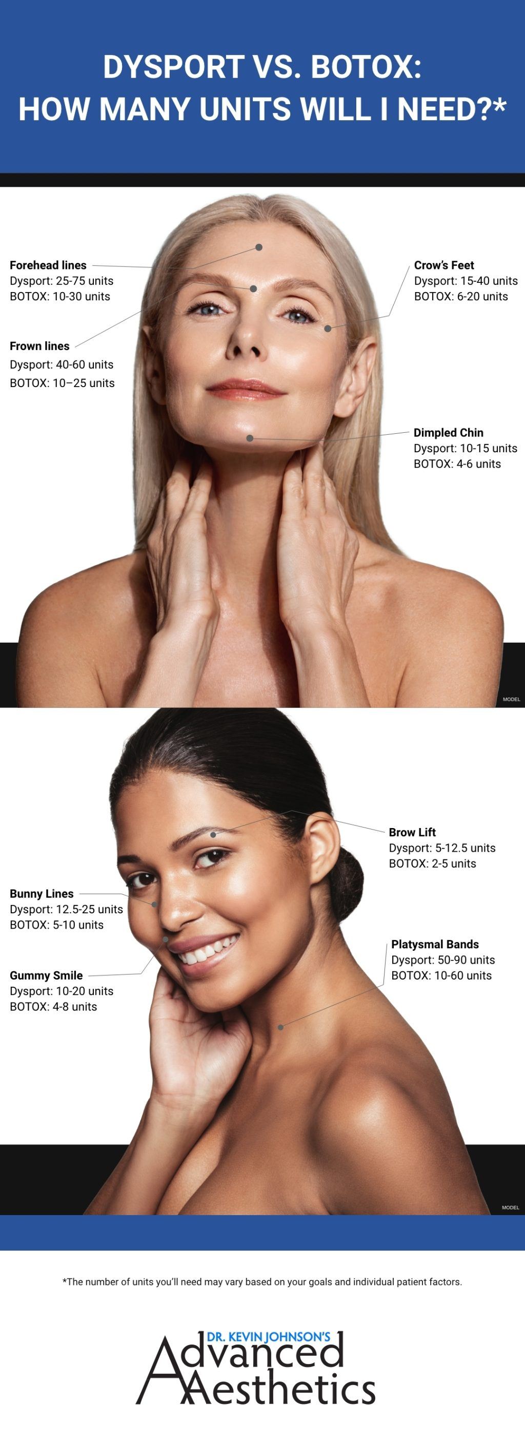 DYSPORT VS. BOTOX:
HOW MANY UNITS WILL I NEED?*

Two women (models) are shown with different points on the face, outlining the treatment areas and unit dosage mentioned below.

Forehead lines
Dysport: 25-75 units
BOTOX: 10-30 units

Frown lines
Dysport: 40-60 units
BOTOX: 10-25 units

Bunny Lines
Dysport: 12.5-25 units
BOTOX: 5-10 units

Gummy Smile
Dysport: 10-20 units
BOTOX: 4-8 units

Crow's Feet
Dysport: 15-40 units
BOTOX: 6-20 units

Dimpled Chin
Dysport: 10-15 units
BOTOX: 4-6 units

Brow Lift
Dysport: 5-12.5 units
BOTOX: 2-5 units

Platysmal Bands
Dysport: 50-90 units
BOTOX: 10-60 units

*The number of units you'll need may vary based on your goals and individual patient factors.
