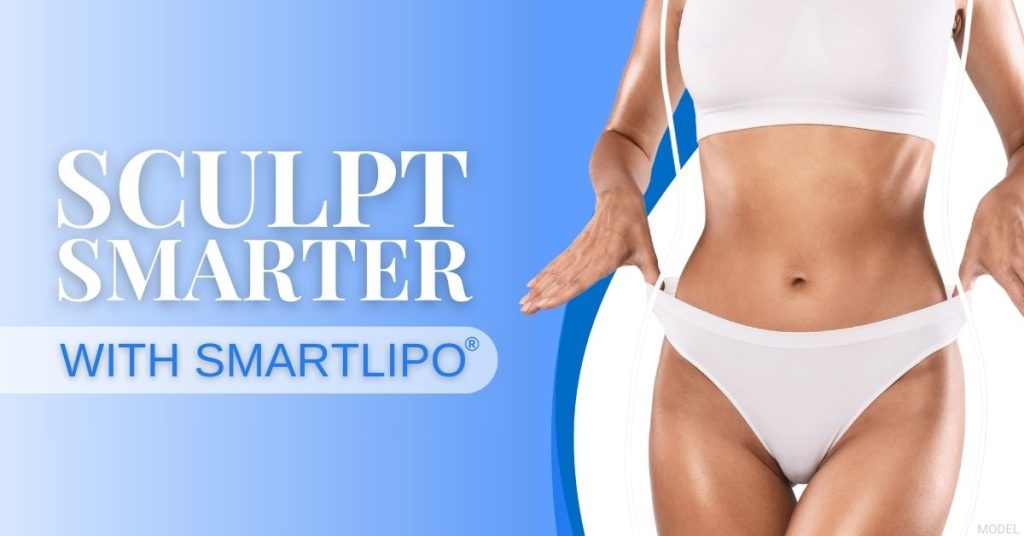 Sculpt smarter with smartlipo. (Model)